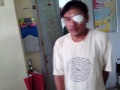 2013-11-13 Surigao II Cataract Patient operated 2.jpg